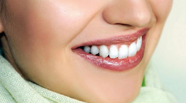 DENTAL VENEERS…YOUR NEW SMILE IN COSTA RICA!
