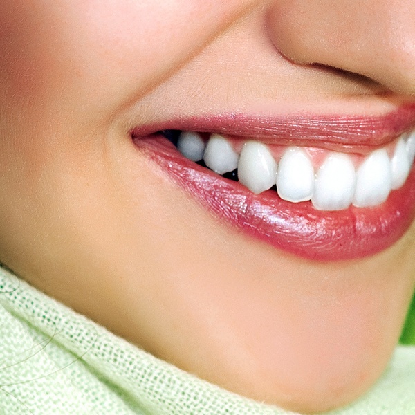 DENTAL VENEERS…YOUR NEW SMILE!